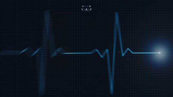 Merjenje utripa v organizaciji